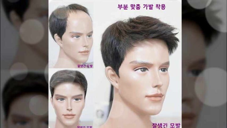  나는남자다가발 남성M자 증모술로 긴 앞머리 스타일이 난다면