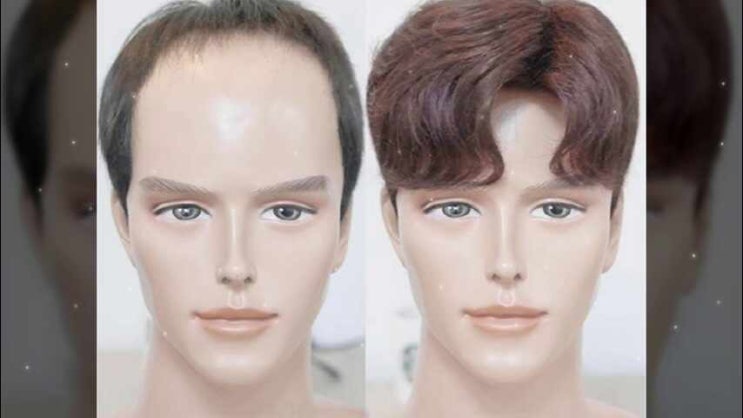  남대문가발 강서구 남자 목동 부분 영등포 남성 서울 맞춤 평택 M자 수원 잠실 용인 의정부 이천 파주 강남 송파 김포 구리 남양주 강동구 천호동 청량리 충무로 오산 군포 종로 일산