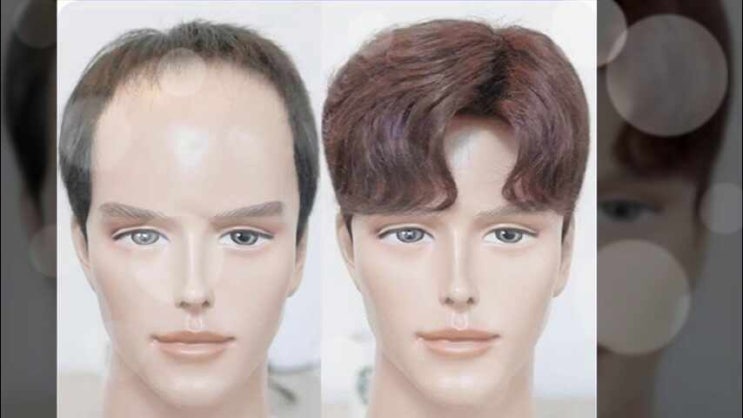  티안나는 가발 남자 앞머리 가디 정수리 광명사거리 가르마 학동 맞춤 철산 인모 노원 가일컷 논현 댄디스타일 청담 쉐도우 하계 m자 상봉 탈모 사거정 신대방삼거리 강남구청 남구로