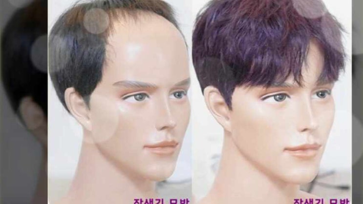  생생정보가발 기성 맞춤 남자 투블럭 스타일로 정수리 탈모에 착용