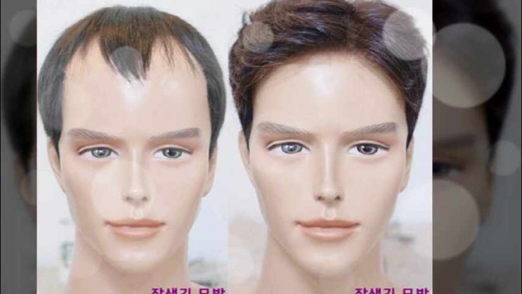  남성 부분가발 제작 파는곳