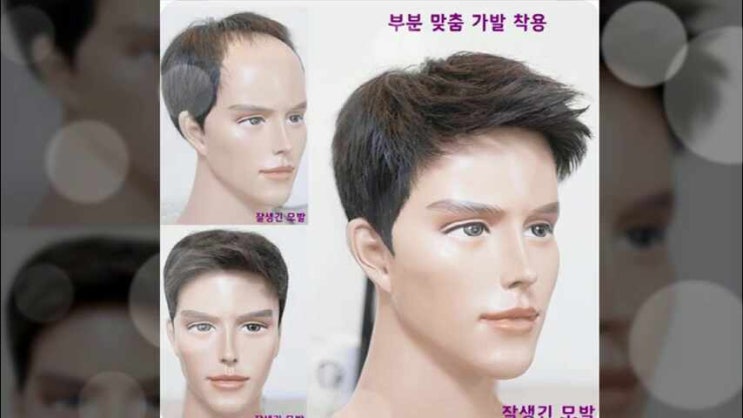 원형탈모가발 M자 머리숱 없는