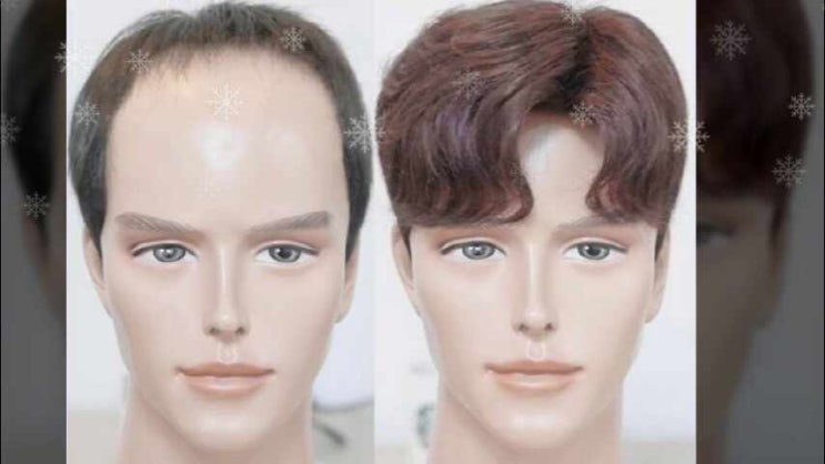  일산 가발 업체 부산 남자 앞머리 붙임머리 기성