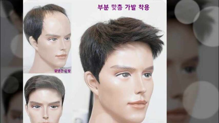  30대 남자정수리부분가발 남성통가발 전체 맞춤