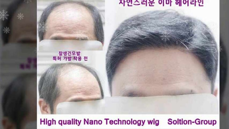 맞춤형 가발 전문 중년 남자 탈모머리 아빠가발