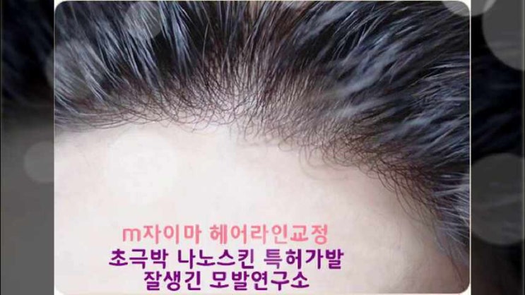  붙이는가발 레이스 프론트보다 자연스러운 통가발