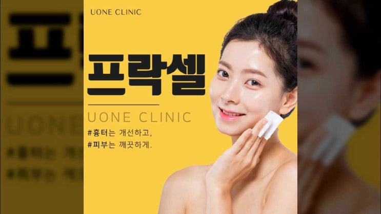  의정부 피부과진료 흉터개선 프락셀 유원의원