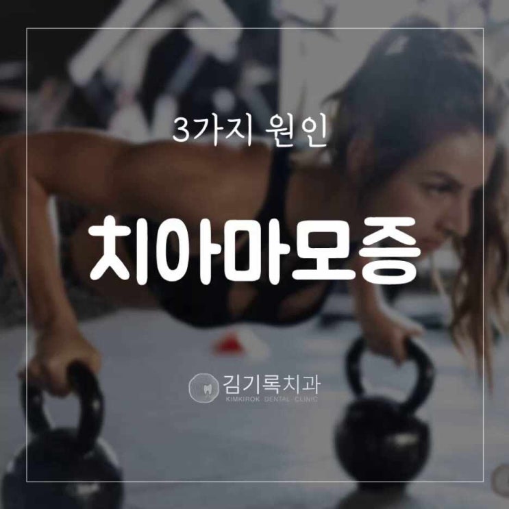 수원과잉치료안하는치과 치아가 자꾸 닳아요! 치아가 닳는 3가지 원인! 치아마모증 원인 3가지