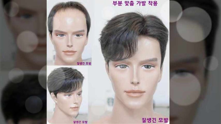  고정식가발 쾌적한 부착형 단추 방식