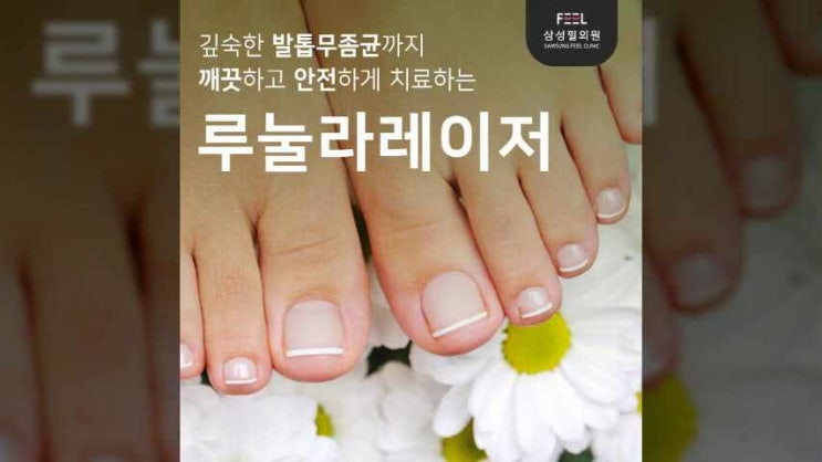  노량진발톱무좀피부과진료 깊숙한 곳까지 레이저로 치료하자