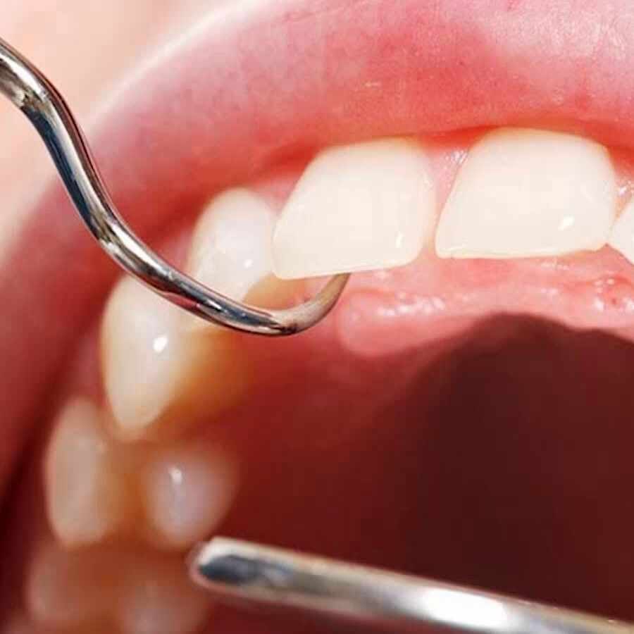 입속 잇몸에서 느껴지는 크고 작은 불편한 증상