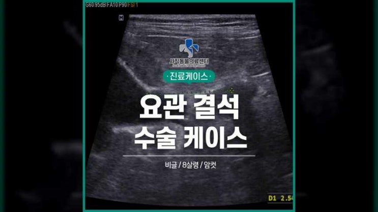 정기적인 건강검진이 필요한 요관 결석 : 네이버 블로그