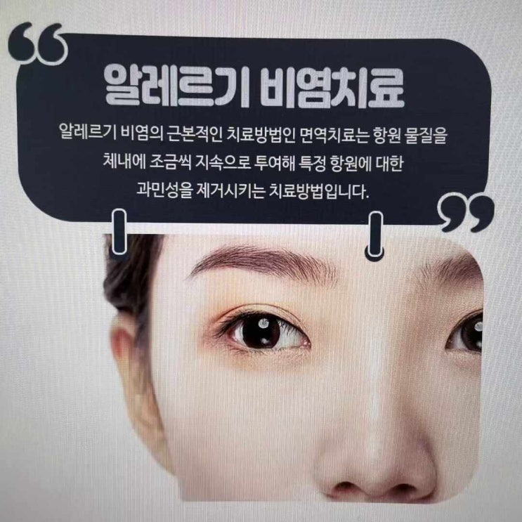 속이 부어서 대구 비염 치료