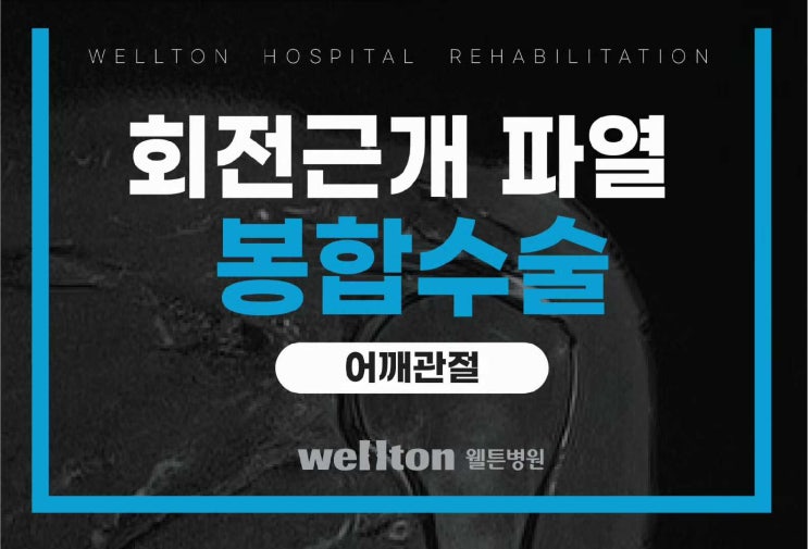  어깨수술정형외과 어깨 회전근개 파열 치료 - 봉합술
