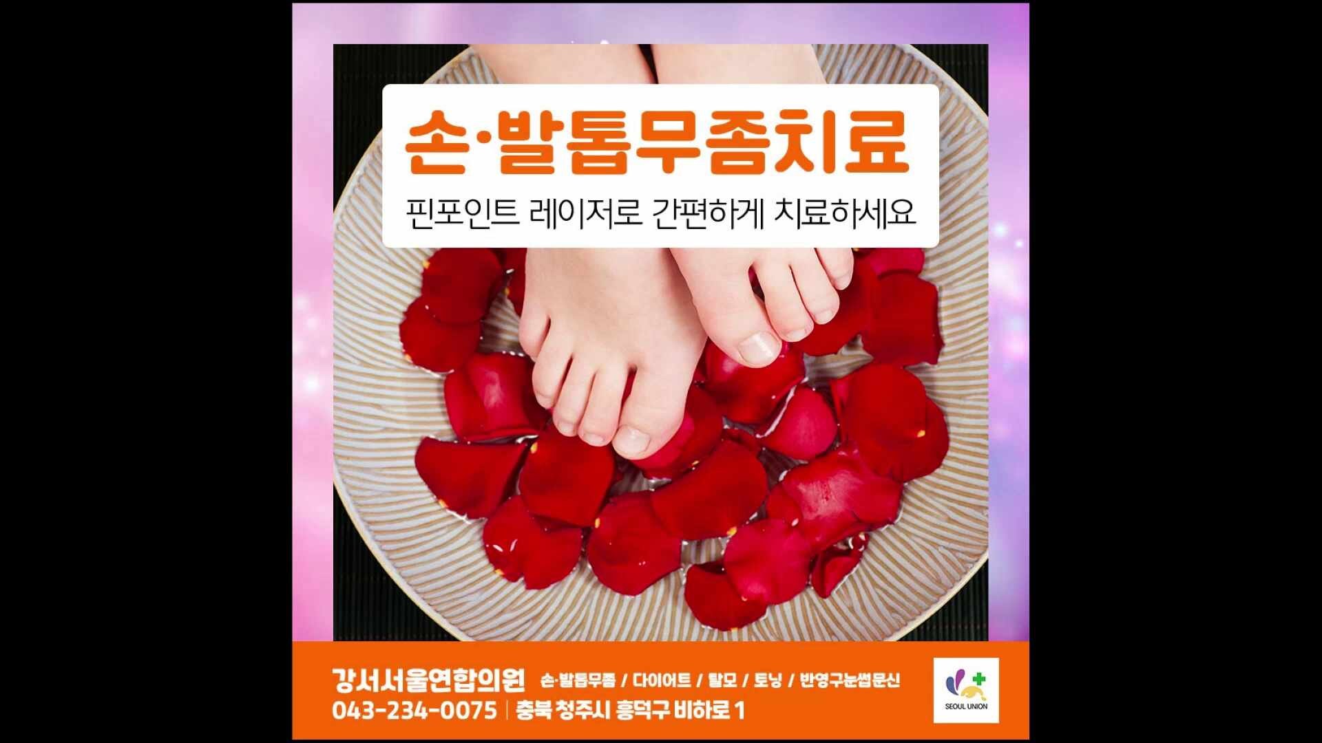 청주발톱무좀병원 치료법부터 관리까지