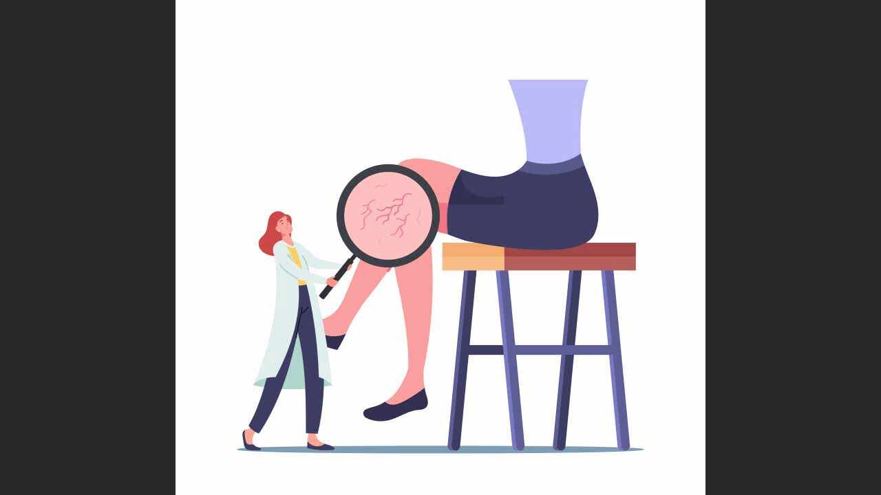 익산하지정맥류 어떤 경우에 위험할까?
