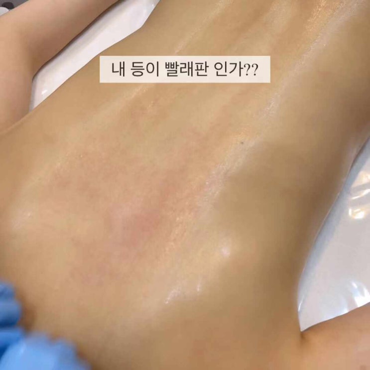  바디 관리, 등 관리  이렇게 하는 곳은 고민해 보세요.
