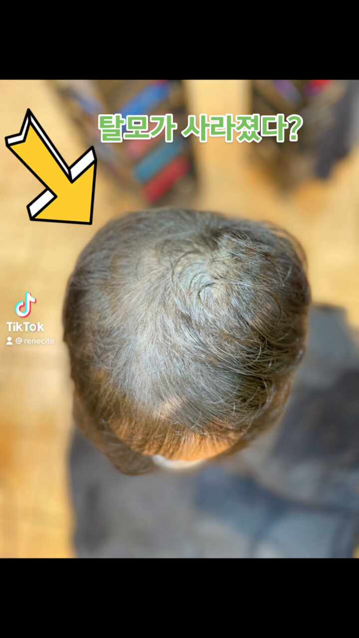  탈모커버성형펌 스페셜영상 다시보기 빨리보세요.  안보면 후회합니다.