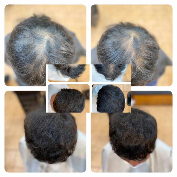  부산탈모관리전문 사상미용실 르네시떼6층 남/여탈모고민 남은 머리카락으로 승부수던진다! 탈모커버성형펌