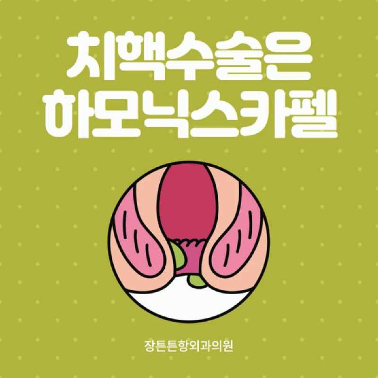 하모닉스카펠 치핵수술 부담없이 : 네이버 블로그
