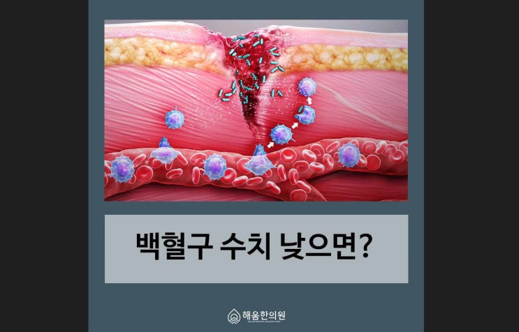 백혈구 수치 낮으면 정상수치와 높이는 방법은? : 네이버 블로그