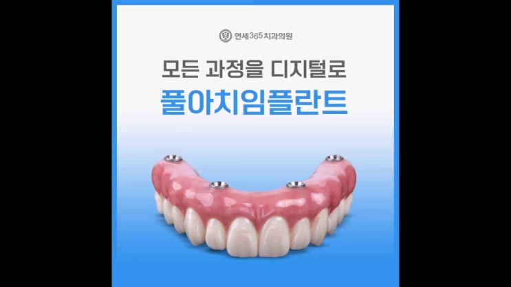  하안동임플란트 컴퓨터 분석을 통해