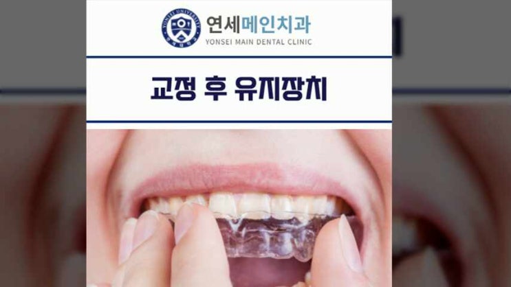  교정 후 유지장치 필요한 이유와 관리하는 방법은?
