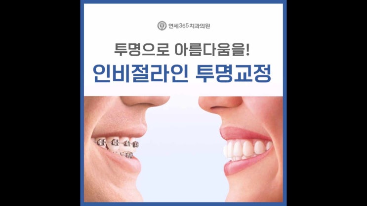  광명동치과 투명으로 아름다움을