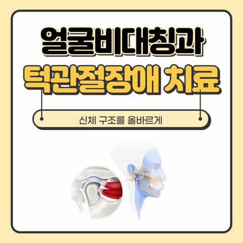 여의도 턱관절치료로 턱뼈 비대칭을 교정해요 [스트레스 턱통증] : 네이버 블로그