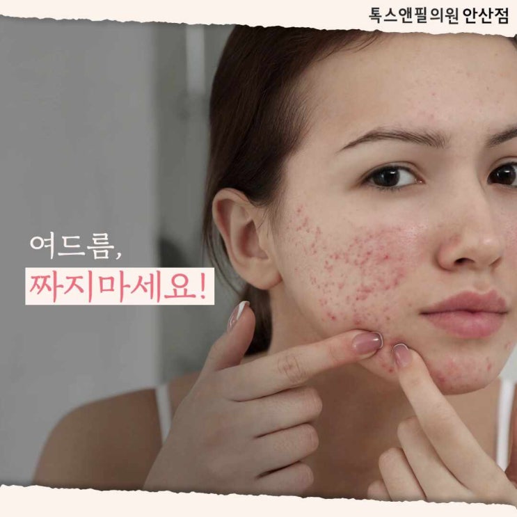  안산여드름 뾰루지 염증주사 톡스앤필중앙역