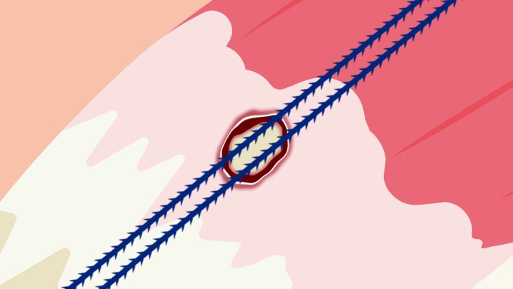 (플래티넘의원) 축소봉합술 - 회전근개파열의 비수술적 치료