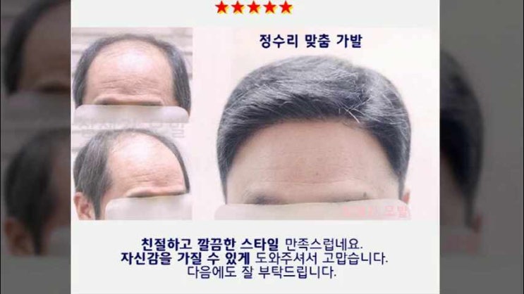  서울대입구 가발 이대 남성 가발 장지 m자 남자 앞머리 원형 탈모 정수리
