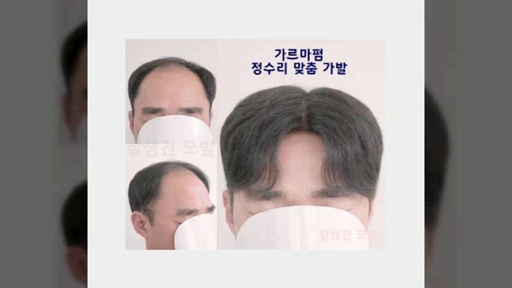 동탄가발 용인 군포 화성 남자 앞머리 정수리