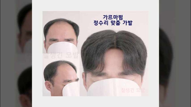  인천가발 남자 부천가발 인모 부평 부분 맞춤 앞머리