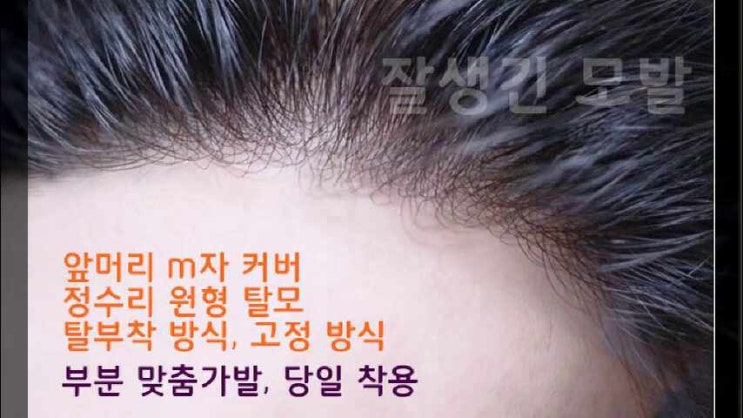  남자M자가발 중년 남성앞머리가발가격