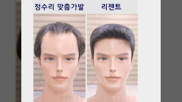  엠자가발 티안나는가발 앞머리 M자부분 군인