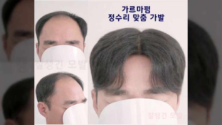  광주가발 청년 정수리앞머리가발 레이스프론트