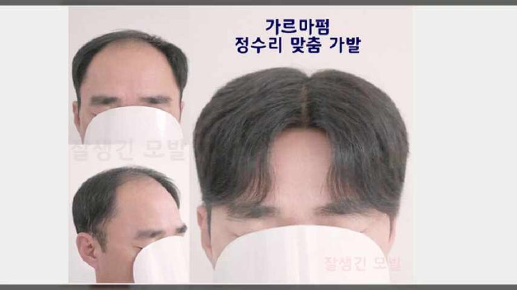  안양가발 수원가발대여 스포츠 압구정