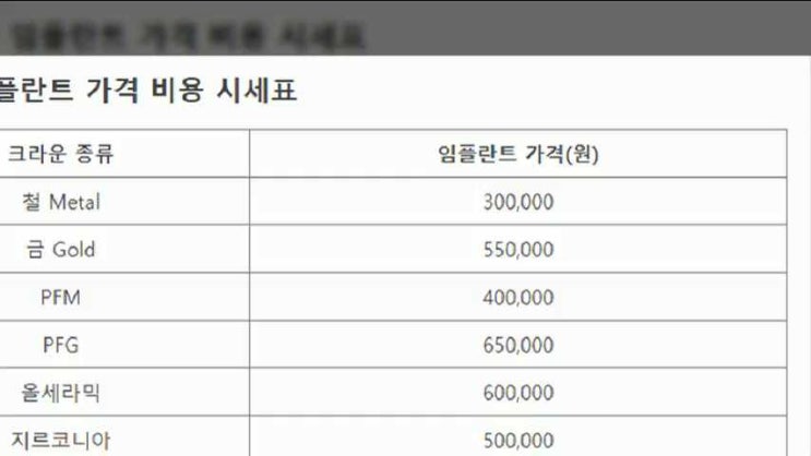 서울 중구 용산구 은평구 종로구 중랑구 임플란트 가격 잘하는 곳 저렴한 싼 곳 유명한 곳 치과 추천