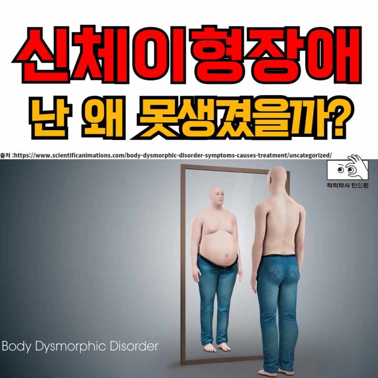  신체이형장애 : 난 왜 못생겼을까? /DSM-5 진단기준/증상/치료/근육이형증 (feat. 오은영 써클하우스)