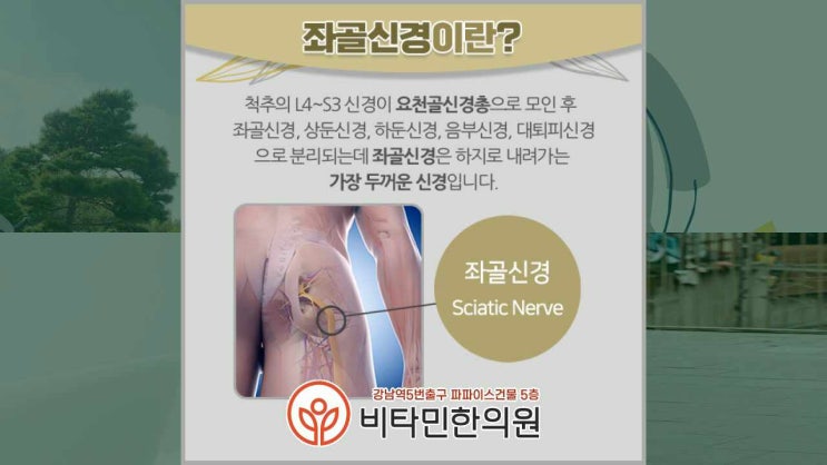 좌골신경통 의자 못 벗어나는 직장인은 조심, 서초동 강남역 추나요법 한의원 : 네이버 블로그