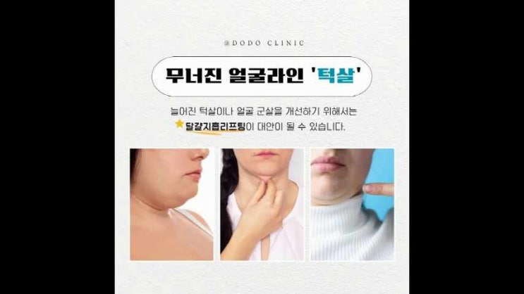 수원 지방흡입과 리프팅으로 늘어진 턱살 해결! : 네이버 블로그