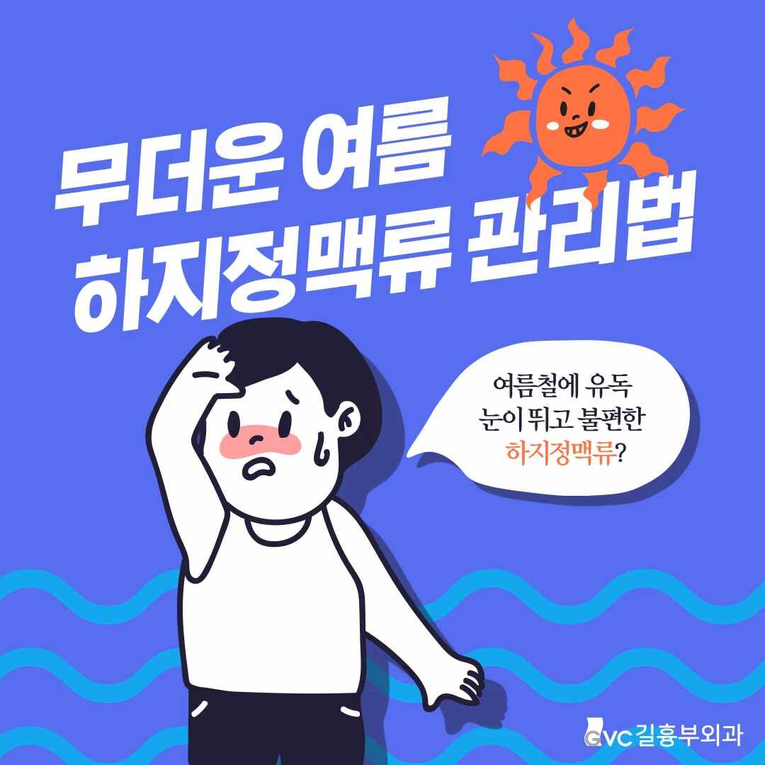 김해하지정맥류 무더운 여름철 하지정맥류 관리법