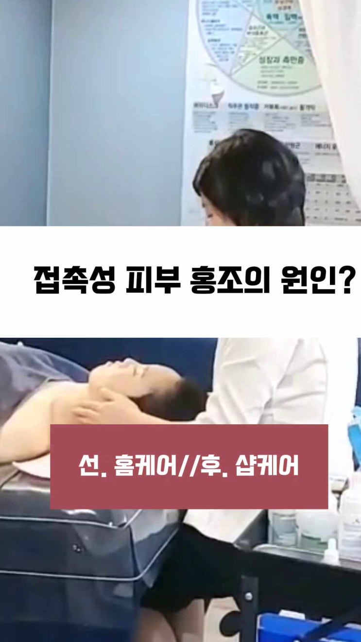  접촉성 피부염 홍조 원인은? 하안동피부관리