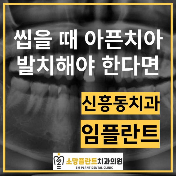  씹을 때 아픈 치아 발치해야 한다면  , 금이간치아, 발치즉시임플란트 원데이임플란트 신흥동치과