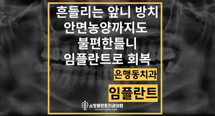  흔들리는 앞니 방치 안면농양까지도 / 불편한 틀니를 임플란트로 회복 은행동 치과