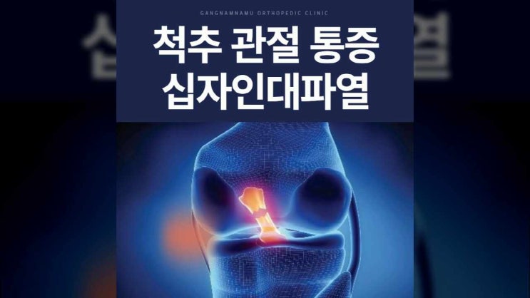 대치동 십자인대파열 올바른 관리로 개선하려면 : 네이버 블로그