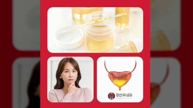  부산 신장내과 거품뇨 증상이 보인다면