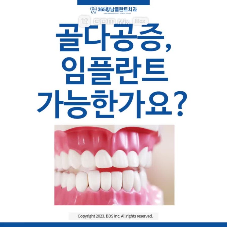  화성 임플란트 잘하는곳, 골다공증 임플란트 수술 시 유의사항