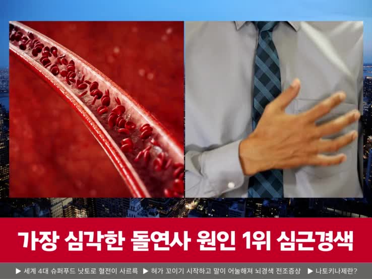  낫또키나제 효능 및 가격비교 소개